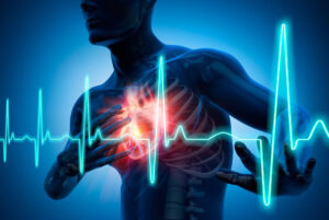 Atrial Fibrillation Fast Heart Rate