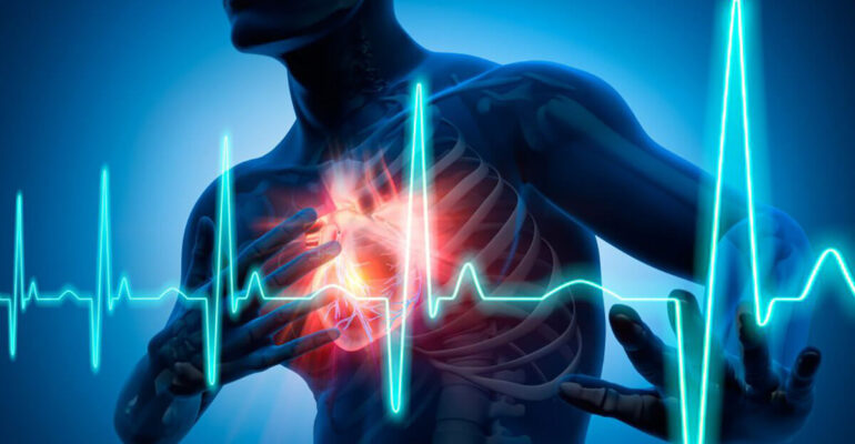 Atrial Fibrillation is a Condition Causing Fast Heart Rate