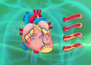 Heart Diseases Awareness
