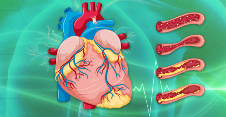 Heart of the Matter; Covid-19 and the Heart